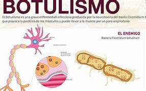 Image result for hotulismo