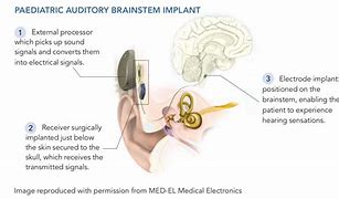 Image result for apba�ear