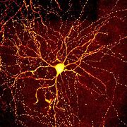Image result for Brain Matter Universe