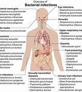Image result for Types of Illness
