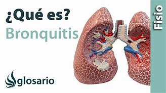 Image result for bronquitis
