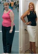 Image result for Major Weight Loss Before and After