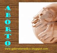 Image result for aborta4