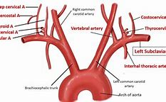 Image result for Left Subclavian Artery Branches
