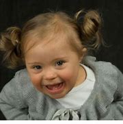Image result for Cute Kids with Down Syndrome