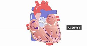 Image result for Atrioventricular Bundle