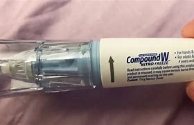 Image result for Compound W Wart Remover Before and After