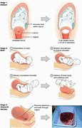 Image result for What Does Cm Look Like in Early Pregnancy