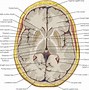 Image result for Brain 34 View