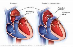 Image result for arterioso