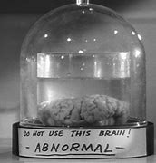 Image result for Young Frankenstein Abby Normal Meme