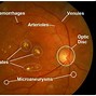Image result for Retina Biometric