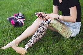 Image result for Natural Prosthetic Limb