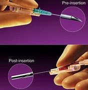 Image result for Uresil Pigtail Catheter