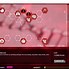 Image result for Total Organ Failure Plague Inc