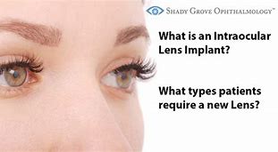 Image result for En Vista Aspire Lens Implant