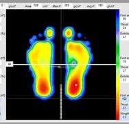 Image result for Electric Foot Sensor Plate