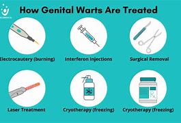 Image result for Genital Wart Removal Products