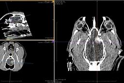 Image result for Meningioma Brain Tumor Dog MRI