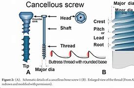 Image result for Screw On iPhone 11" Case