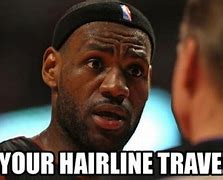 Image result for LeBron Hairline Meme