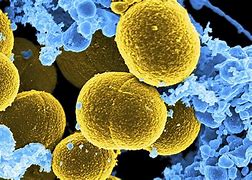 Image result for Allergy Bacteria