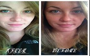 Image result for Remove Tan From Face Before After