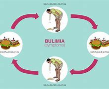 Image result for bulimia
