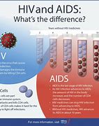 Image result for What Is HIV and Aids