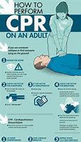 Image result for When to Do CPR