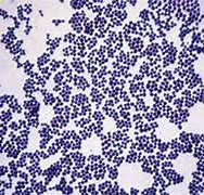 Image result for Gram Stain Positive Cocci