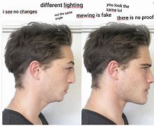 Image result for Mewing Side Profile