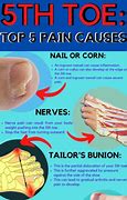 Image result for Sharp Pain in Pinky Toe