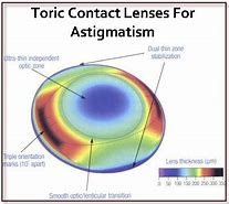 Image result for Toric Contact Lenses for Astigmatism