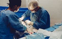 Image result for Gist Tumor Surgery