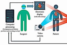 Image result for Robot Augmented Surgery