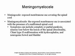 Image result for Meningomyelocele Sac