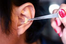 Image result for Human Ear Wax