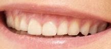 Image result for Cara Delevingne Teeth