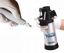 Image result for Cryo Wart Removal