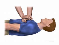 Image result for What Is CPR On Adults