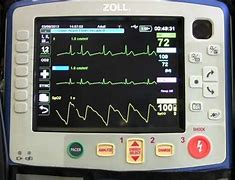 Image result for Zoll Propaq
