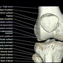 Image result for PFL Muscle
