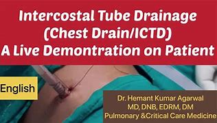 Image result for Chest Tube Suction