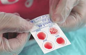 Image result for How to Check Blood Type
