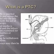 Image result for PTC Internal External Drain