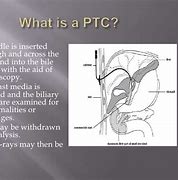 Image result for PTC Drainage