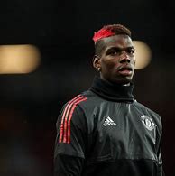 Image result for Pogba Bald