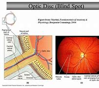 Image result for Optic Disc and Blind Spot