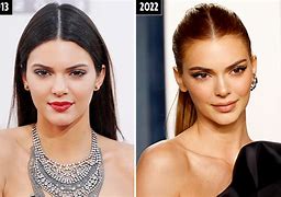 Image result for Kendall Jenner Eye Surgery